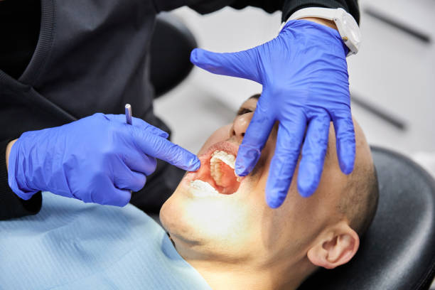 Best Emergency Root Canal Treatment in Camden, OH
