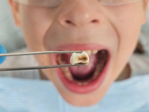 Best Orthodontic Emergency Dentist in Camden, OH