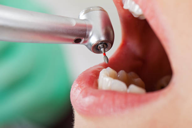 Best Weekend Emergency Dentist in Camden, OH